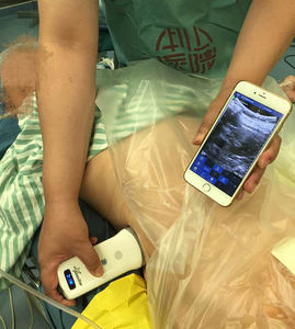 Mesin <span class=keywords><strong>Ultrasound</strong></span> Nirkabel Portabel Multi-Sistem SonoStar - Product Image 3