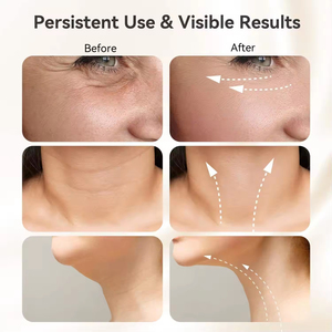 Rouleau de massage facial rechargeable à 3 modes pour le soin anti-âge de la peau, design portable et facile à nettoyer - Product Image 5