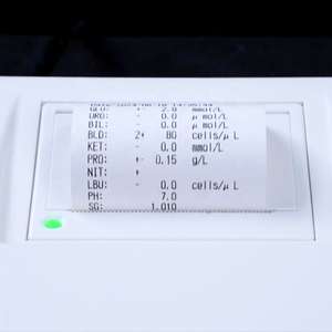 Analizador <span class=keywords><strong>de</strong></span> <span class=keywords><strong>Orina</strong></span> HTSY Mini Semi-Automático, Analizador Bioquímico <span class=keywords><strong>de</strong></span> <span class=keywords><strong>Orina</strong></span> con Tiras Reactivas, 10 Parámetros - Product Image 3