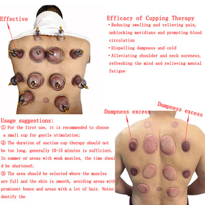 Peralatan pistol pijat plastik, terapi fisik tradisional Cina, peralatan pijat bekam vakum kekuatan isap tinggi - Product Image 3