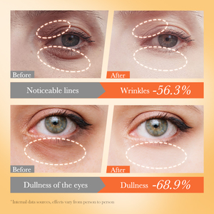 OEM FAYANKOU <span class=keywords><strong>precio</strong></span> al por mayor personalizado vitamina C brillo multi-Acción antiarrugas <span class=keywords><strong>ojeras</strong></span> reafirmante nutritiva Crema para los ojos - Product Image 4