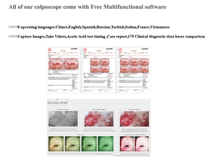Colposcope optique binoculaire Kernel <span class=keywords><strong>KN</strong></span>-2200BI avec <span class=keywords><strong>filtre</strong></span> vert pour examen gynécologique vaginal - Product Image 6
