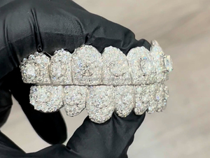Joyería Fina Estilo Hip Hop Set Honeymoon de Grills de Diamantes para Dientes, Grills Personalizados con Moissanita VVS Helada y Piedra Central Grande - Product Image 3