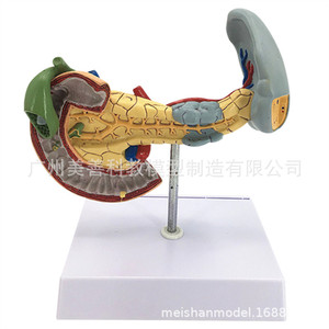 Modèle de simulation pédagogique des tissus pathologiques du pancréas, de la rate, du foie, de la vésicule biliaire et du duodénum ; spécimen pathologique du pancréas - Product Image 4
