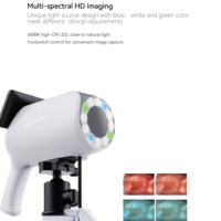 Colposcope vidéo numérique HD Kernel GN-500, 5,12 MP, conçu pour le dépistage cervical et l'examen gynécologique régulier.
