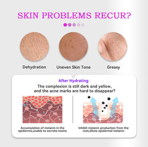 <span class=keywords><strong>DR</strong></span>.ROSEVA Nettoyant pour la peau de Nettoyant pour le visage sans sulfate Contrôle de l'huile et anti-acné et Aloe Vera et escargot Nettoyant pour le visage pour toutes les peaux - Product Image 6