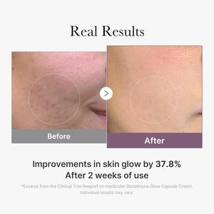 كريم الوجه ميديكيوب AGE-R Glow Capsule للشد الفوري والترطيب مع الكولاجين والببتيد لتوحيد لون البشرة، منتج كوري للعناية بالبشرة - Product Image 6