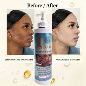 Loción Corporal Correctora de Manchas Oscuras OEM, Aclara e Iguala <span class=keywords><strong>el</strong></span> Tono de Piel, Ácido Kójico, Miel, Hidratación Profunda, Reafirmante, la <span class=keywords><strong>Mejor</strong></span> Loción Corporal - Product Image 2
