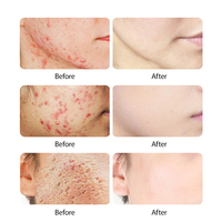 Crème Visage Bio 30g à Prix Bas pour Soin Quotidien de la Peau, Élimination des Marques d'Acné et Réparation Cutanée