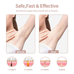 <span class=keywords><strong>Appareil</strong></span> d'<span class=keywords><strong>épilation</strong></span> au laser <span class=keywords><strong>professionnel</strong></span> à refroidissement par glace saphir, haute énergie 21J, IPL, portable, 510k, utilisation à domicile - Product Image 4