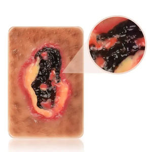 Model Luka Jaringan Necrotic KyrenMed 3 Jenis Model Luka Necrosis Basah dan Kering untuk Pendidikan Perawatan Luka - Product Image 4