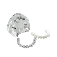 Modelo Anatómico de Implante Dental, 6 Implantes, Mandíbula Superior e Inferior, Restauración de Sobredentadura, Dientes Removibles, Educación, Estudio, Enseñanza