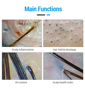 Dermatoscópio para Uso Doméstico Diagnóstico do Couro Cabeludo Detecção de Umidade Analisador de Pele e Cabelo com Tela - Product Image 4