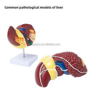Modèle anatomique du foie pathologique humain pour l'école de médecine pour l'étude et la recherche sur les caractéristiques pathologiques du foie - Product Image 6