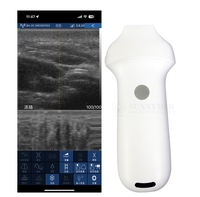Sonde d'échographie portable sans fil 20 Hz à 192 éléments pour soins esthétiques de la peau