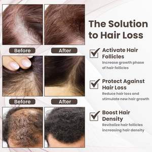 10% GHK-CU <span class=keywords><strong>Copper</strong></span> Peptide Hair Growth Treatment <span class=keywords><strong>Serum</strong></span> 5% AHK-CU with Aloe Vera Herbal Ingredients Anti-Aging Liquid Formula - Product Image 5