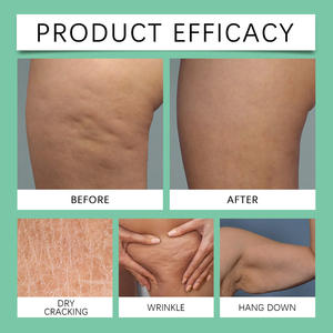 Crema suave para la piel, antienvejecimiento, crema corporal para la piel de todo el cuerpo, loción corporal reparadora calmante hidratante brillante - Product Image 4