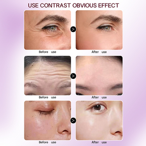 Mascarilla Facial y Corporal de Colágeno en Polvo, 100% Natural y Orgánica, con Pétalos de Rosa, Blanqueadora y para el Tratamiento del Acné - Product Image 5