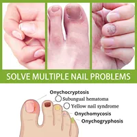 Comprimés de gingembre et de sel d'Epsom OEM ODM pour la réparation des ongles atteints de mycose, la relaxation musculaire et les soins spa