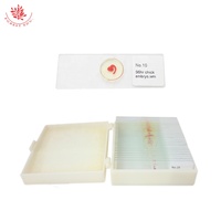 Diapositives d'embryon de poulet Science médicale poussin préparé Microscope diapositives enseignement éducatif poussin préparé diapositives