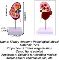 Reno normal y enfermo con perspectiva dual para patología, anatomía humana y educación CE/ISO