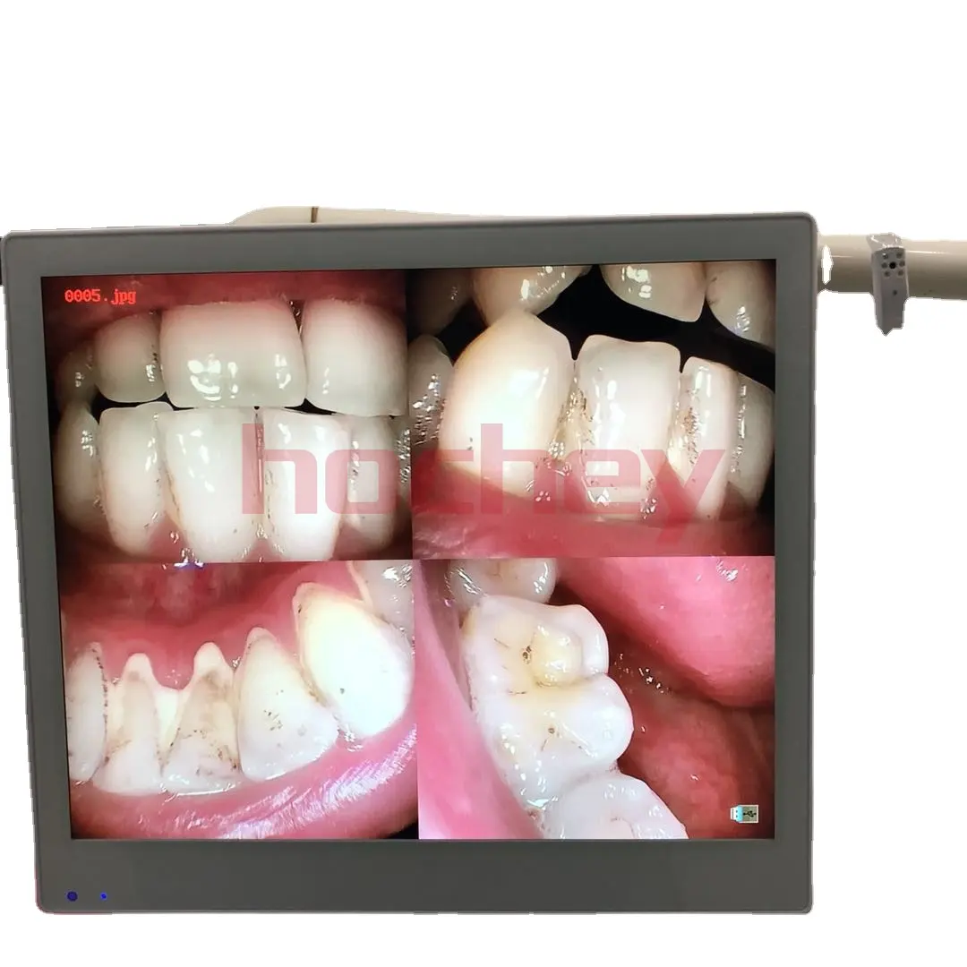 HOCHEY MEDICAL 17 polegadas qualidade sem fio digital USB endoscópio intraoral dental câmera intraoral com monitor