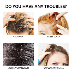 <span class=keywords><strong>Shampoo</strong></span> Gel OEM alle Erbe e Limone <span class=keywords><strong>Antiforfora</strong></span>, Purificante, Illuminante, Idratante e Nutriente per un Cuoio Capelluto Sano - Product Image 4