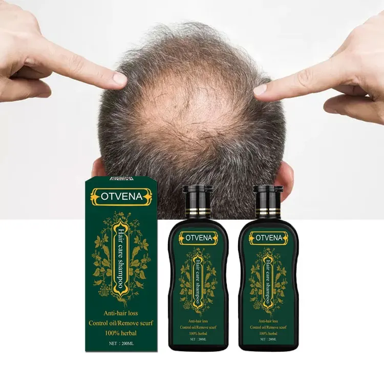 Men's hair care products anti hair loss herbal hair growth shampoo