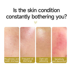 Venta caliente Limpieza Control de aceite Hidratante Mejora de la tez Arroz integral Extracto de <span class=keywords><strong>levadura</strong></span> Control de aceite Base DE LA PIEL Esencia Agua - Product Image 5