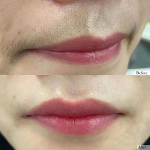 Superlaser Portable Dermatology Commercial Diode <span class=keywords><strong>Laser</strong></span> 808nm Appareil de beauté pour l'épilation au <span class=keywords><strong>laser</strong></span> de la peau Fabriqué en Chine - Product Image 3