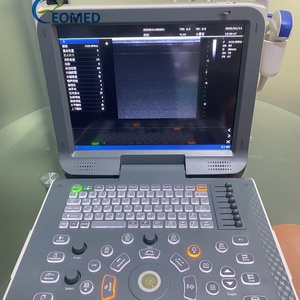 Portable Human Veterinary Ultrasound <b>Scanner</b> with Color Doppler Multi-Frequency Probe for Comprehensive Diagnostic CU60-1 - Product Image 5