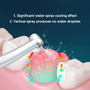 Nouveau produit : Tête <span class=keywords><strong>de</strong></span> coupleur rapide compatible LED haute vitesse pour équipement dentaire, idéale pour les procédures <span class=keywords><strong>de</strong></span> couronnes et bridges - Product Image 5