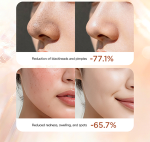 <span class=keywords><strong>Masque</strong></span> Facial Nettoyant en Profondeur à l'Argile Blanche Amazone et Extrait de Curcuma, Contrôle du Sébum, Éclaircissant, Anti-Acné - Offre Spéciale - Product Image 3