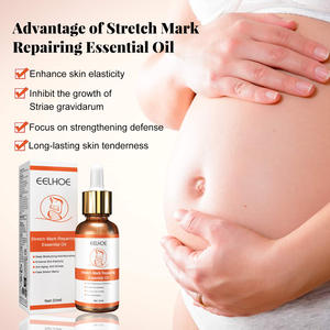 Aceite esencial para el cuidado de la piel prenatal y posparto, piel del vientre femenino, arrugas sueltas, esencia hidratante - Product Image 2