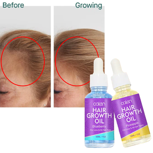 เซรั่มน้ำมันปลูกผมสับปะรดออร์แกนิก30มล. สำหรับผมทุกประเภท - Product Image 1