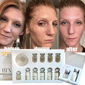 Máscara <span class=keywords><strong>de</strong></span> enzima <span class=keywords><strong>de</strong></span> elevación <span class=keywords><strong>de</strong></span> etiqueta privada, máscara Facial <span class=keywords><strong>de</strong></span> bruja milagrosa, máscara <span class=keywords><strong>de</strong></span> contorno <span class=keywords><strong>de</strong></span> escultura facial reafirmante en V - Product Image 1