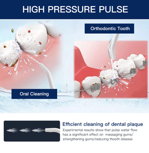 Irrigador Bucal Eléctrico Inalámbrico Portátil con Carga USB, Resistente al Agua IPX8, Limpiador <span class=keywords><strong>Dental</strong></span> Blanqueador de Dientes - Product Image 5