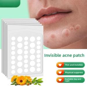 カスタムロゴ新デザインにきびスポットパッチティーツリーオイルにきびヒーリングパッチスキンケア用 - Product Image 4