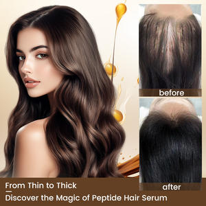 Sérum naturel anti-chute Prévenir la perte de cheveux Traitement Croissance rapide Nourrir endommagé Chute Ghk-cu Peptide Sérum de croissance des cheveux - Product Image 4