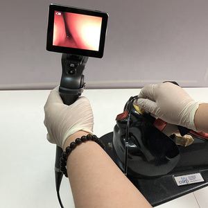 Portée portable Intubation des voies respiratoires bronchoscope Laryngocope vidéo flexible - Product Image 2