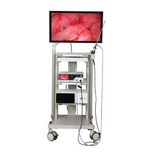 Sistema de câmera laparoscópica profissional 4K com luz fria LED | CE certificado para cirurgia | Direto de fábrica | Personalização OEM - Product Image 3