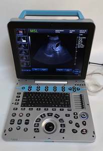 Dawei Medical Abdomen Ginecología Neonatal Máquina de ultrasonido de diagnóstico 4D <span class=keywords><strong>5D</strong></span> Trolley Color Doppler Electricidad 19 pulgadas de alto - Product Image 3