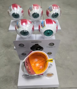 Modelo de Ojo Anatómico Premium de PVC, 3 Partes, 3D, con Cataratas, para Enseñanza, Diseño Desmontable de 3 Partes - Product Image 3