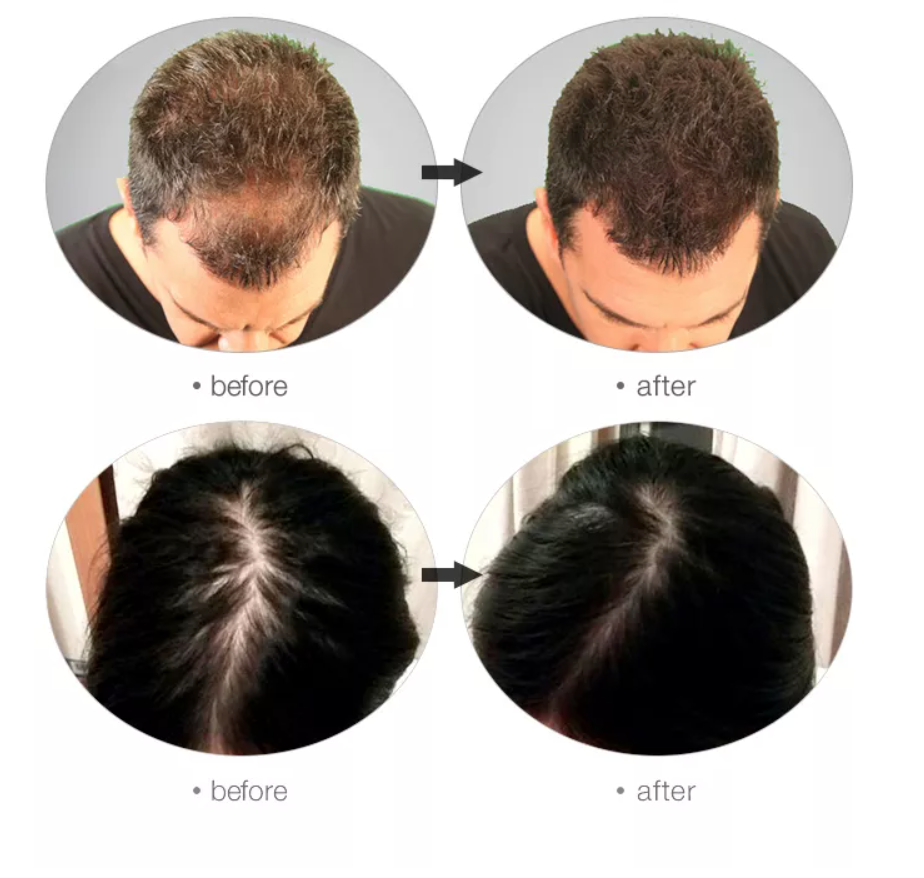 FEG PLUS Hair Growth Spray - Natural Argan Oil Nourishment