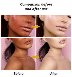 Viên nang mềm làm sáng da, trắng da, bổ sung Glutathione và Collagen, nhãn hiệu riêng OEM/ODM - Product Image 4