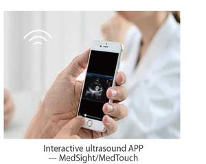 Mindray-sistema de ultrasonido para diagnóstico de DC-60, alta calidad, para uso hospitalario - Product Image 5