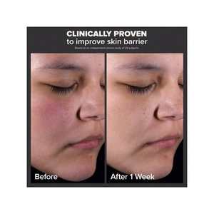 Exfoliante Líquido Skin Perfecting 2% BHA con Ácido Salicílico para Todo Tipo de Piel, 118 ml, Cuidado Facial - Product Image 2