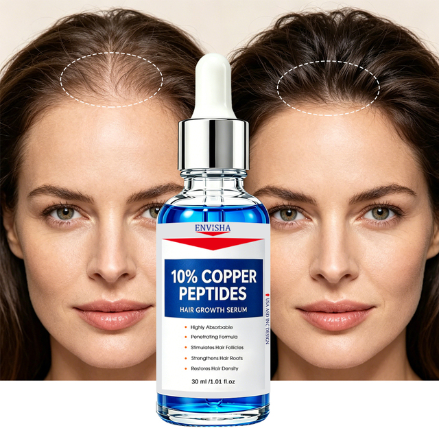 OEM/ODM Natural Herbal Prevent Hair Loss Increase Hair Density Strengthen Roots Promote 10% Copper Peptides Hair Growth Serum