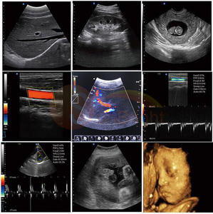 Professionele Cardiale Kleur <span class=keywords><strong>Doppler</strong></span> Echografie 15 Inch Pc-Gebaseerde Dieren Kleur <span class=keywords><strong>Doppler</strong></span> - Product Image 3
