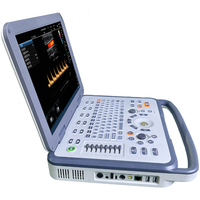 Échographe Doppler Couleur Ergonomique VS-BN60 avec Écran LCD 15 Pouces pour l'Abdomen, l'Obstétrique et la Gynécologie